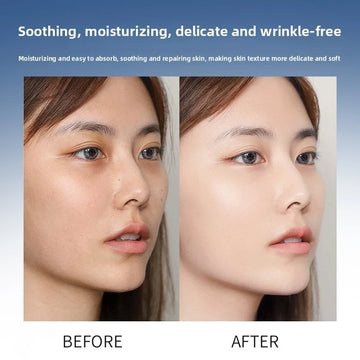 Sérum à l'acide hyaluronique anti-âge hydratant, resserre les pores, essence blanchissante pour instruments à micro-aiguilles, soin de la peau
